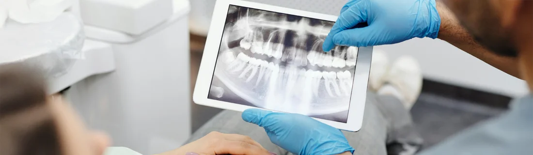 Digital X-Rays in Media PA